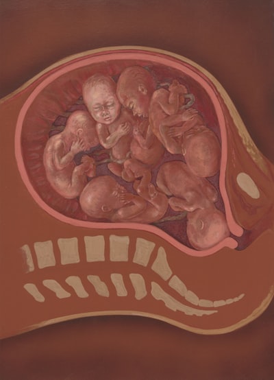 Blog Images